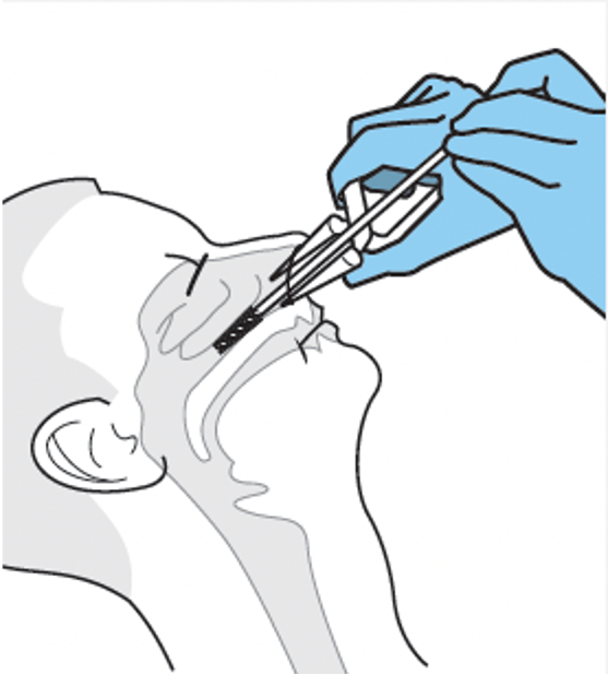 Graphical representation of two gloved hands collecting a nasal swab brushing from a person