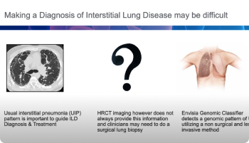 Preview thumbnail for video. Text: Making a diagnosis of interstitial lung disease may be difficult